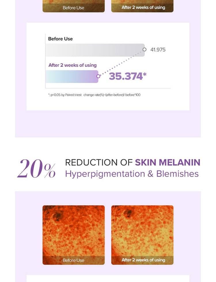Tranexamic Acid + Glutathione Eye Cream Mini