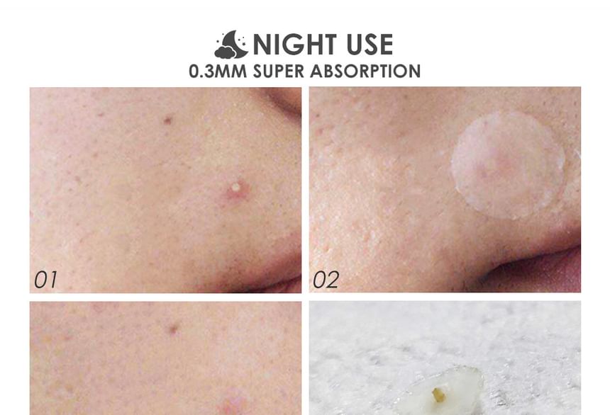 Acne Pimple Patch-Day & Night
