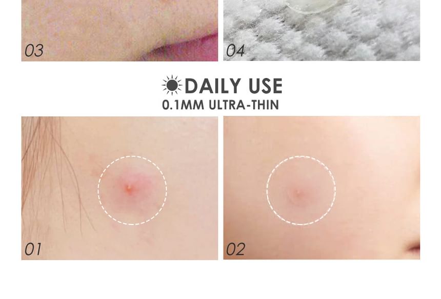 Acne Pimple Patch-Day & Night