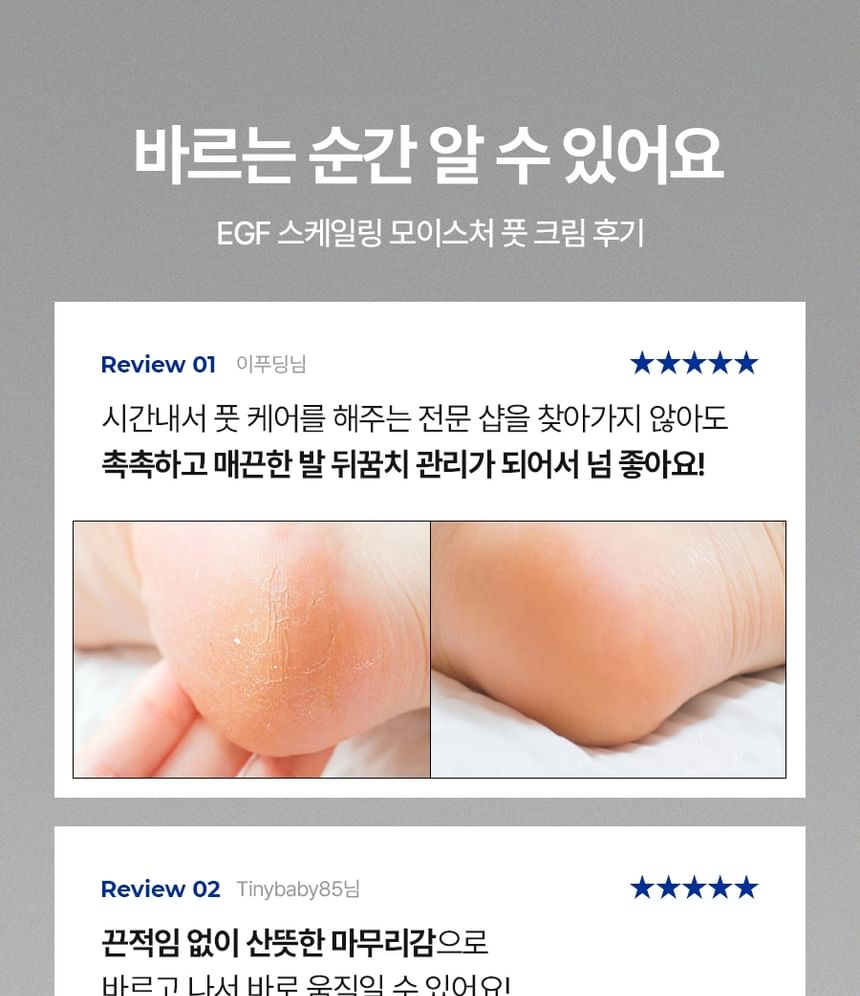 EGF Scaling Moisture Foot Cream 2.0 2pcs Bundle Set