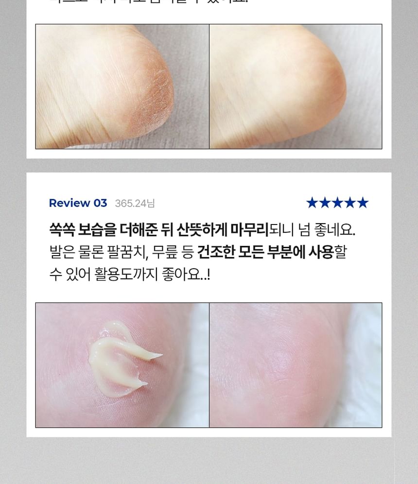 EGF Scaling Moisture Foot Cream 2.0 2pcs Bundle Set