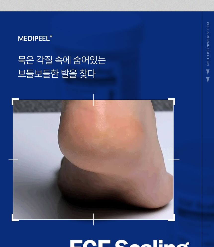 EGF Scaling Moisture Foot Cream 2.0 2pcs Bundle Set