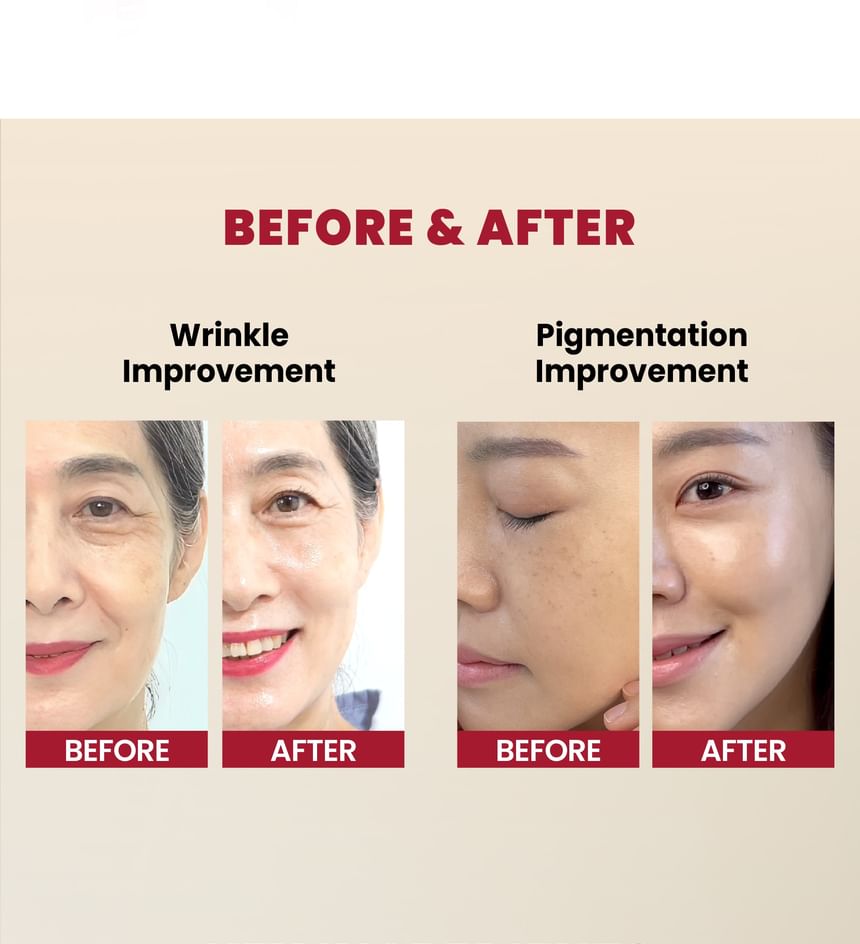 SEOUL 1988 Serum : Retinal Liposome 2% + Black Ginseng