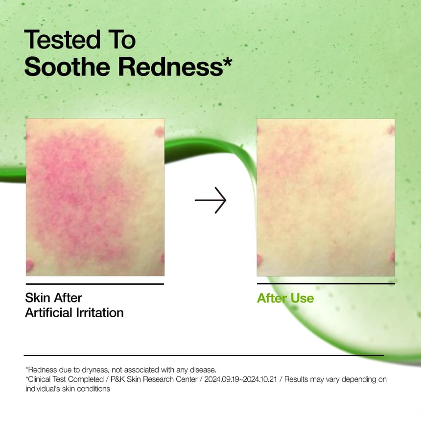 Azelaic Acid 10 Hyaluron Redness Soothing Serum 2pcs Bundle Set