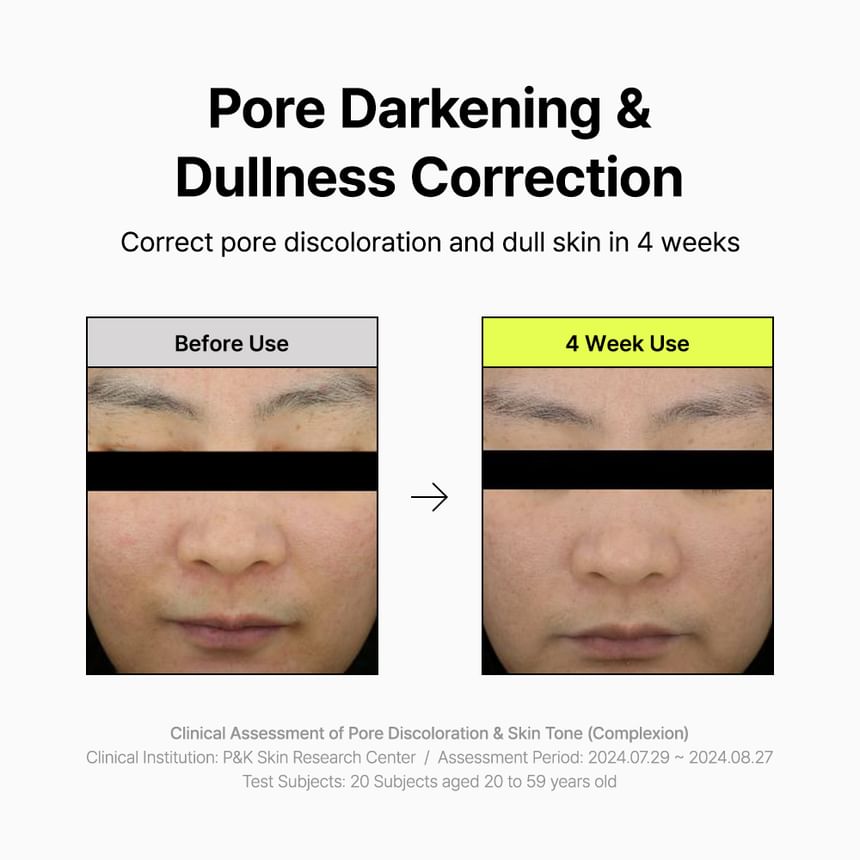 Pore Smoothing Bakuchiol Serum Mini