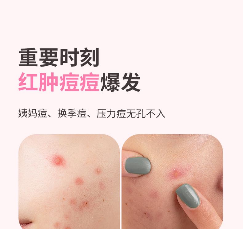 Pure Radiance Acne Pimple Patch - 3 Types