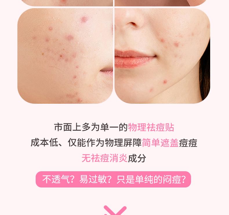 Pure Radiance Acne Pimple Patch - 3 Types