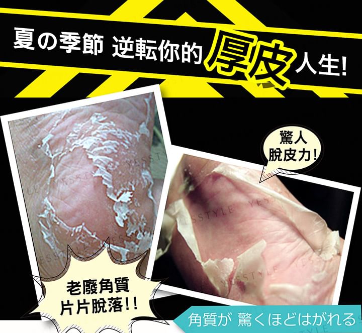 Hard Skin Removal Black Foot Mask 5pcs Bundle Set