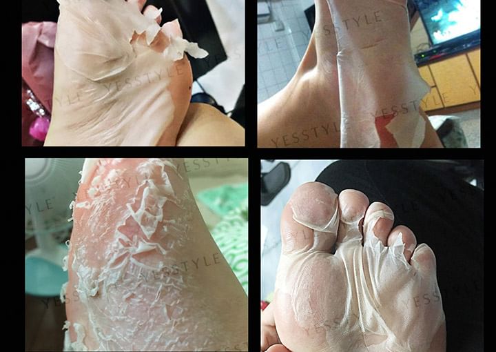 Hard Skin Removal Black Foot Mask 5pcs Bundle Set