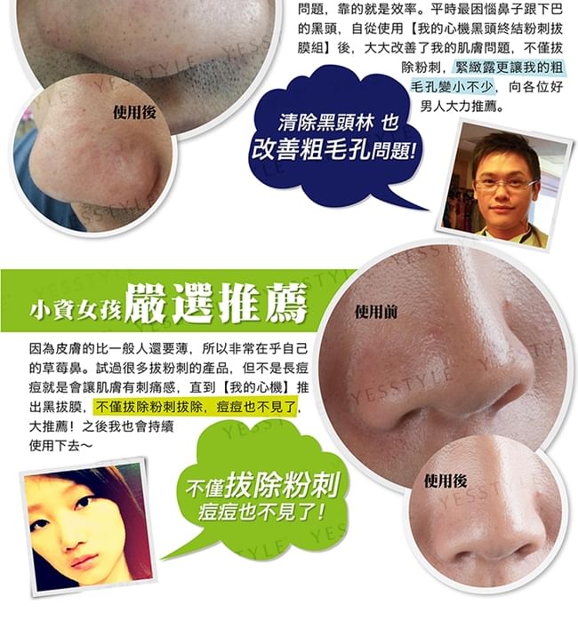 Blackhead Removal Activated Carbon Mask Set