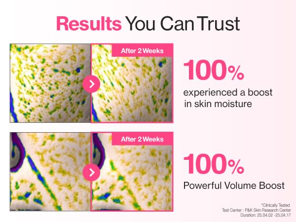 No.2 Rose PDRN Collagen Plumping Sheet Mask 10pcs Set