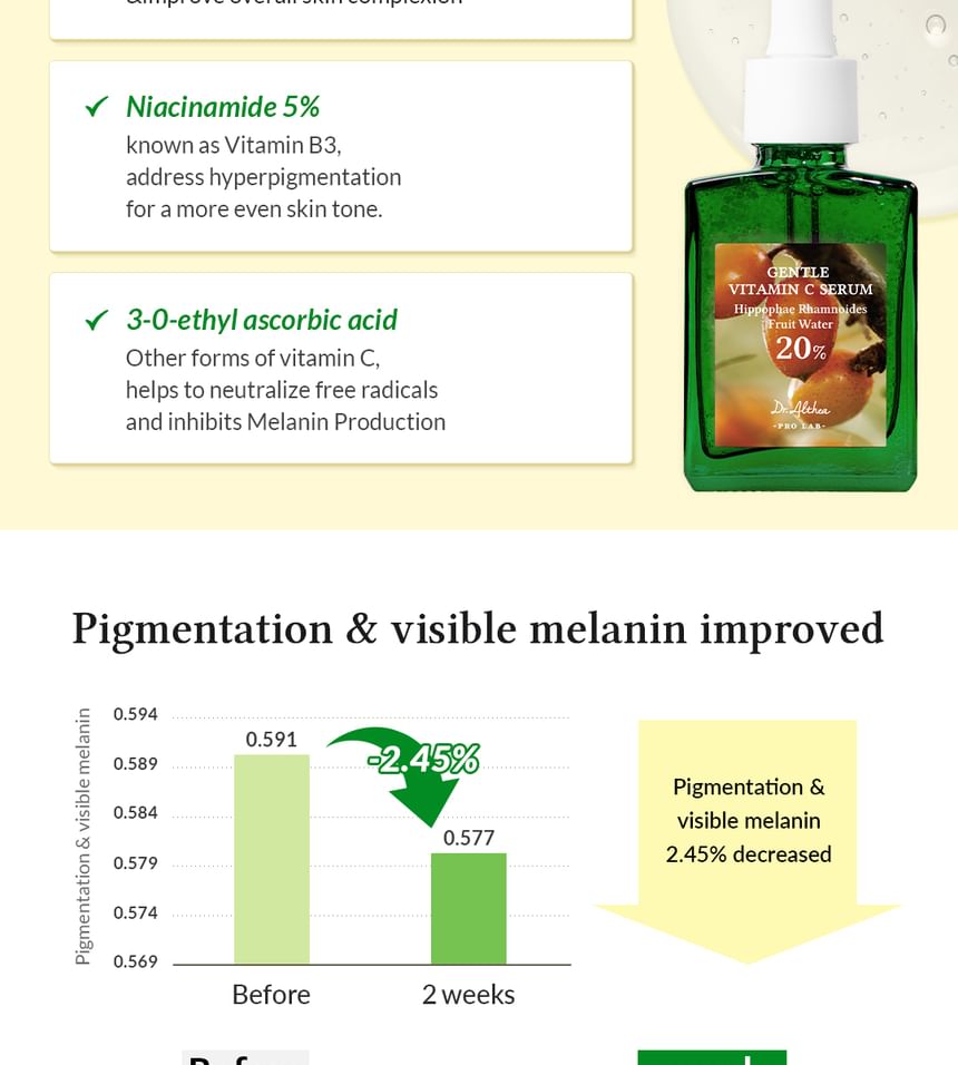 Gentle Vitamin C Serum