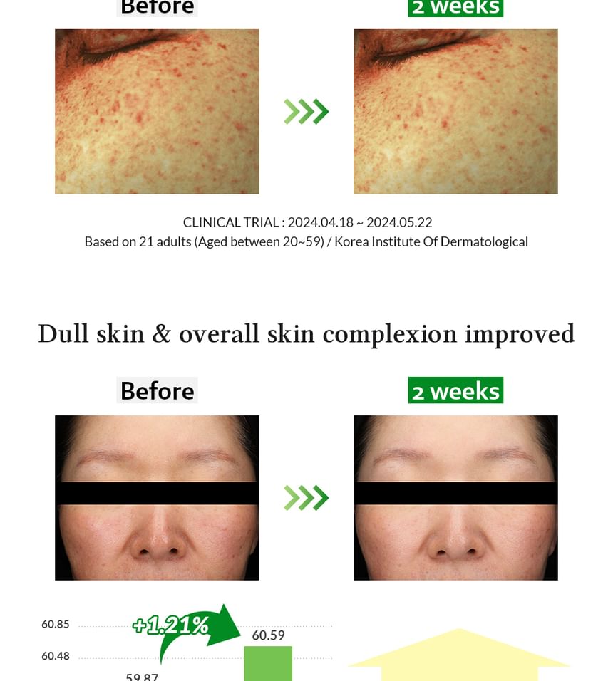 Gentle Vitamin C Serum