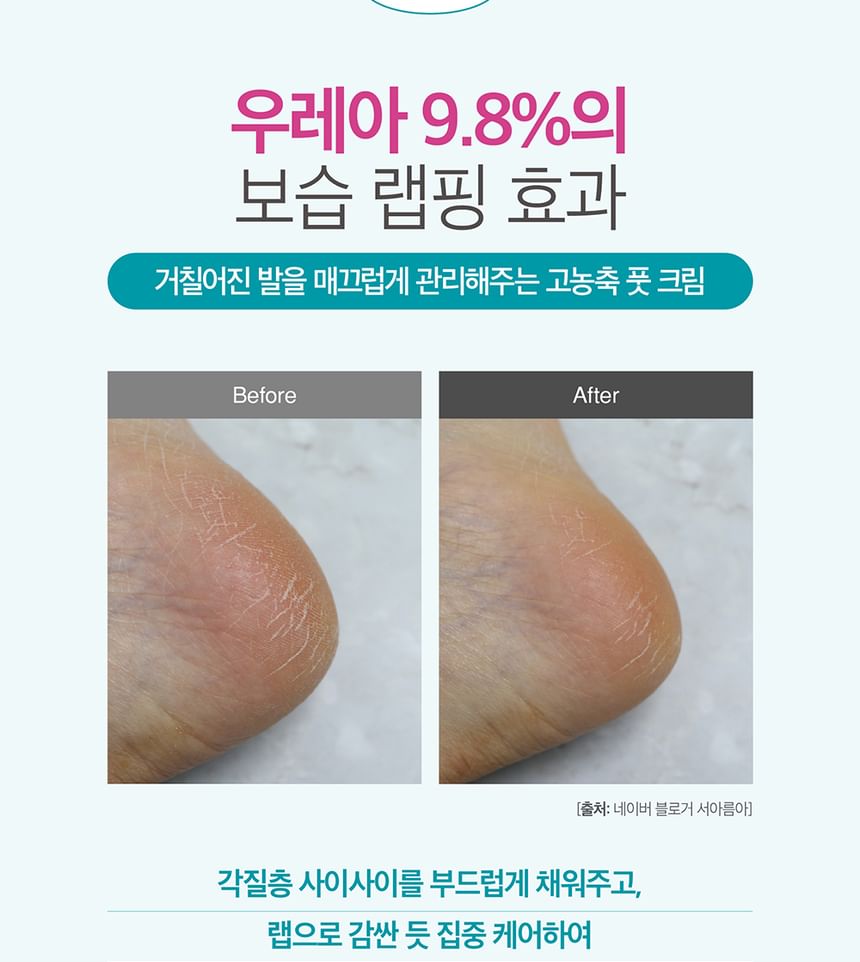 Urea Foot Cream
