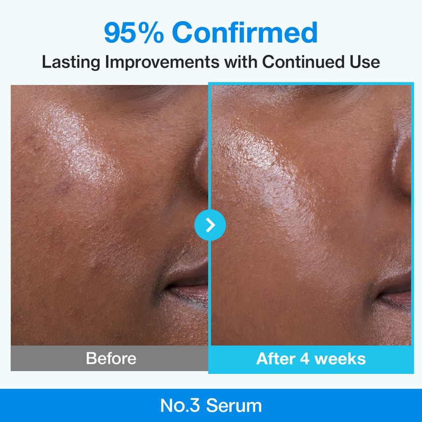 No.3 Blue Bio-Retinol Pore Refining Serum Vial Set