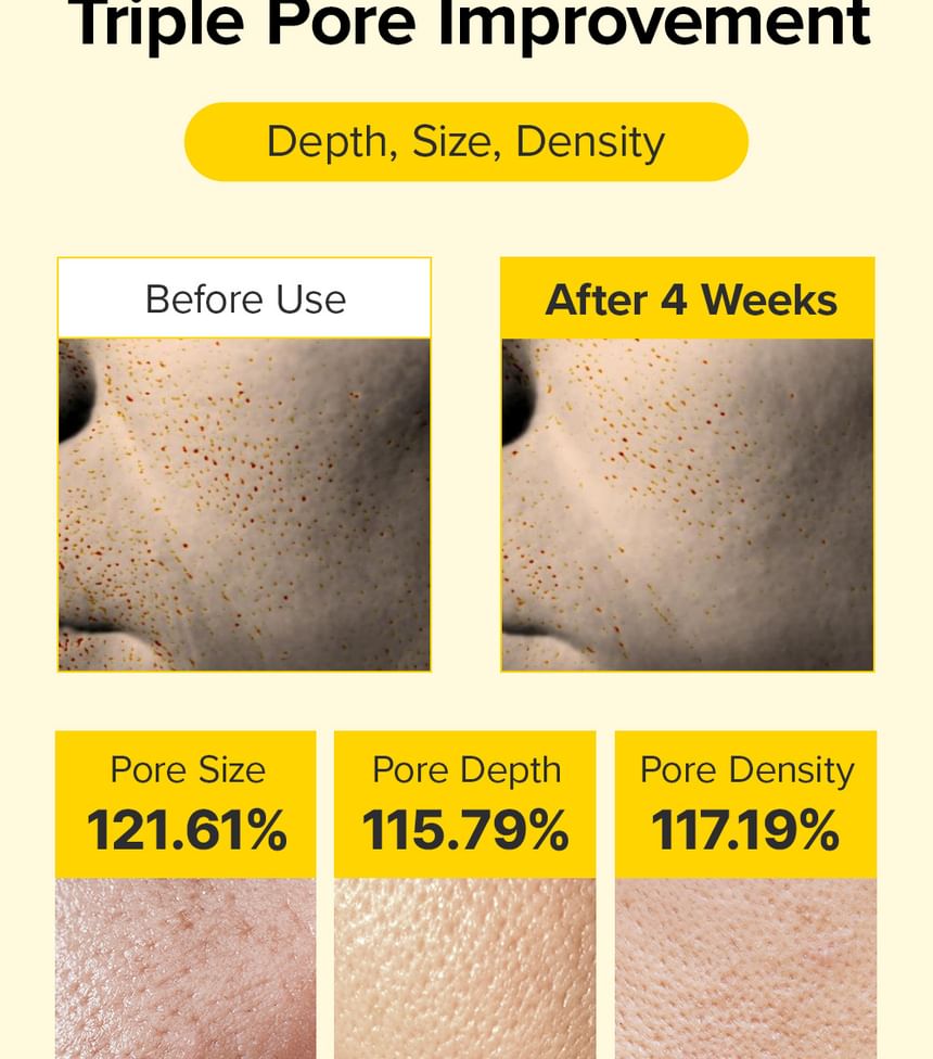 Spicule Retinol PDRN Cream
