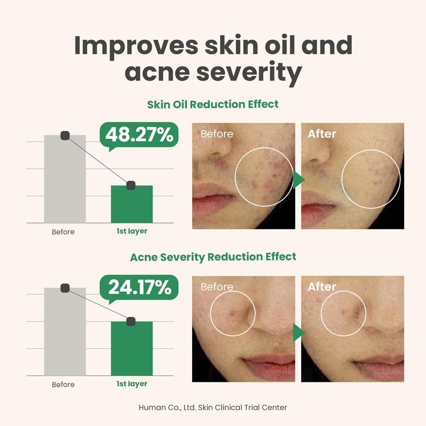 Spot The Difference Blemish Treatment