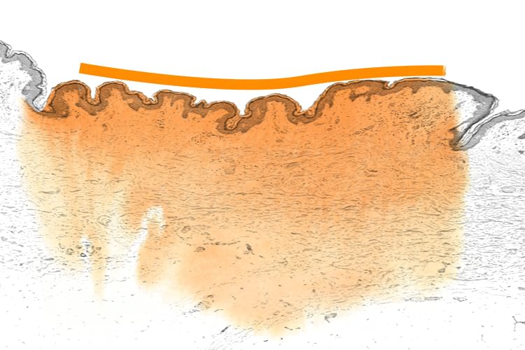 Lyuh Esther Curcumin Direct