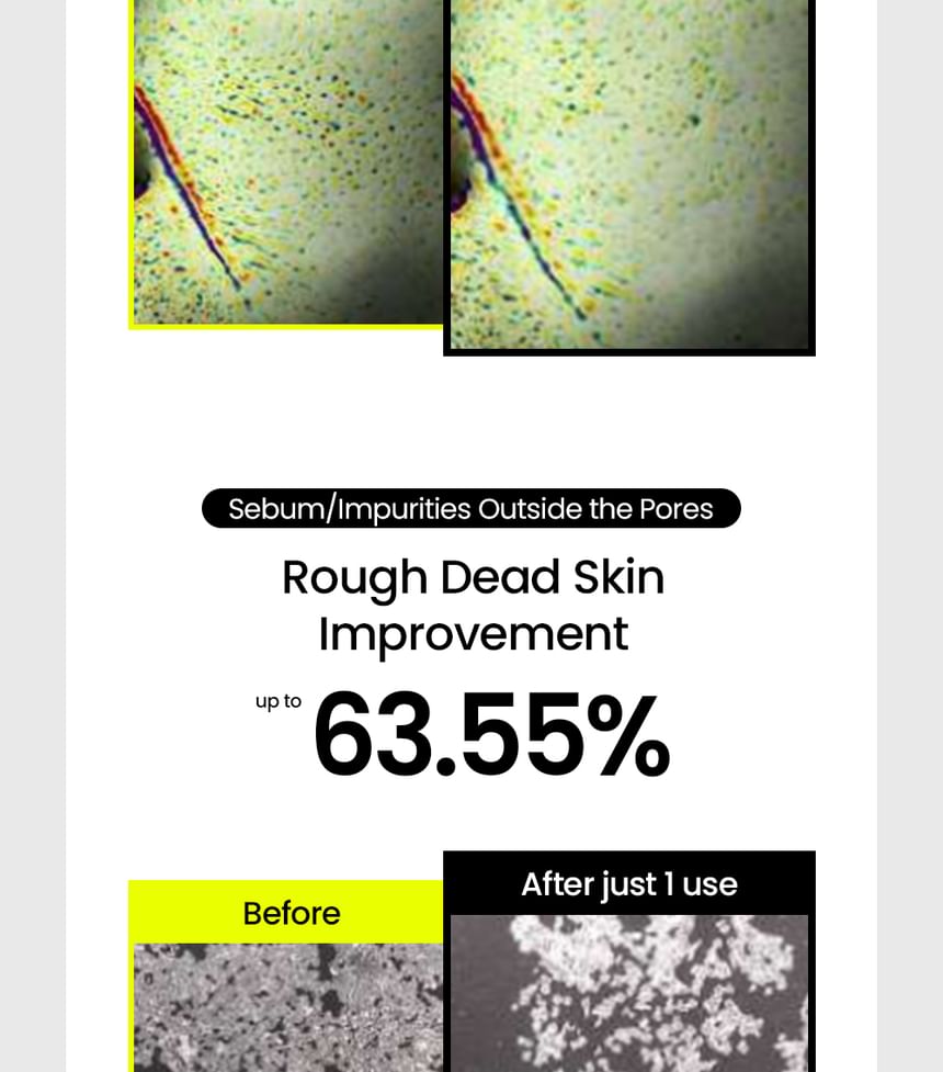 Mung Bean Pore Scaling Water