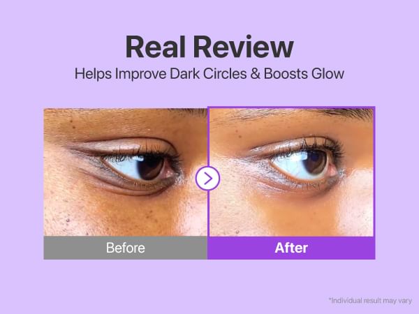 No.9 NAD+ Retinol Volumetox Eye Cream 2pcs Bundle Set