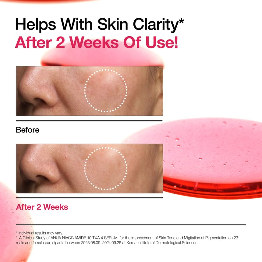 Niacinamide 10 TXA 4 Serum 2pcs Bundle Set