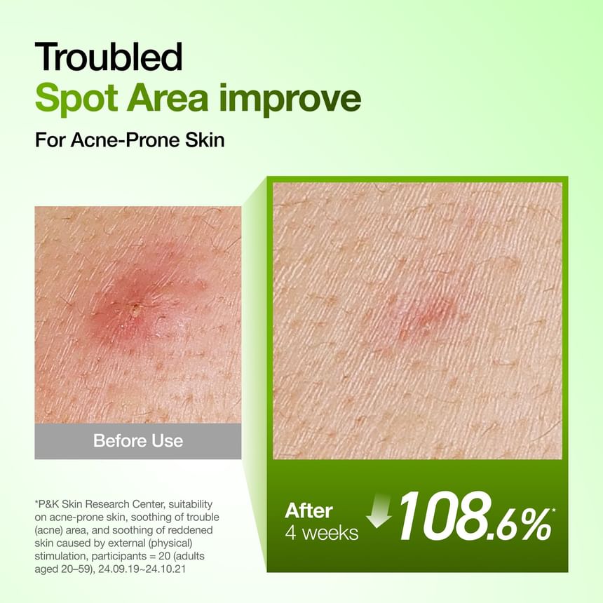 Azelaic Acid 10 Hyaluron Redness Soothing Serum Set Kpop Demon Hunters Collaboration 2pcs Bundle Set