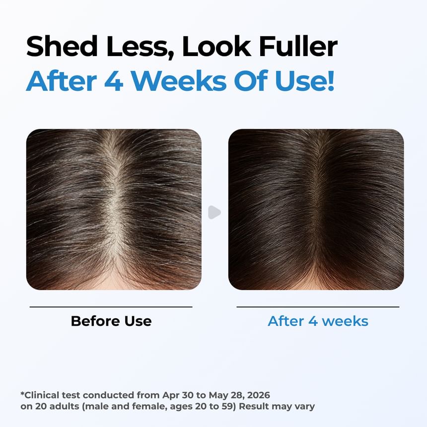 Scalpy Hair Serum