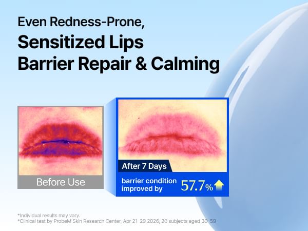 Blue EGF Barrier Lip Balm