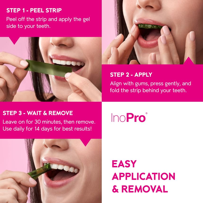Innovative Whitening Strips 2pcs Bundle Set