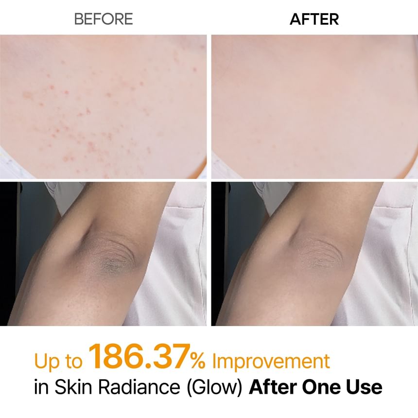 Kojic Acid Body Care Duo Set