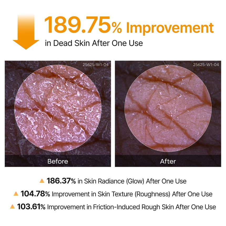 Kojic Acid Body Care Duo Set