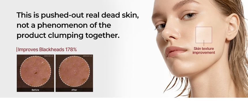 Body & Face Peel Shot Duo Set